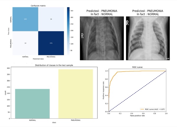 Chest X-ray model evaluation charts
